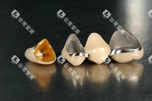 全瓷牙冠材料展示 全瓷牙冠材料展示