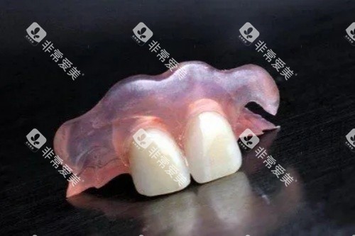 活动义齿卡通图 活动义齿卡通图