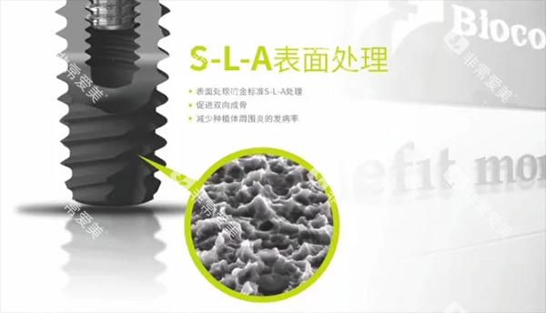 百康特种植牙种植体表面设计