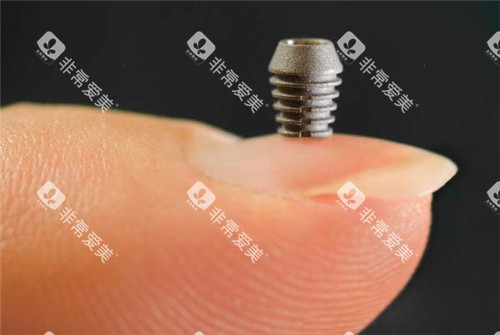 美国百康种植牙展示 美国百康种植牙展示