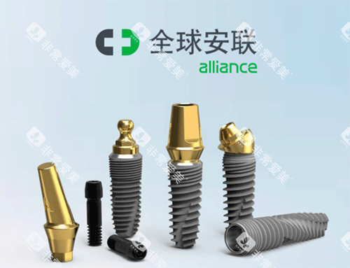 安联种植牙什么档次