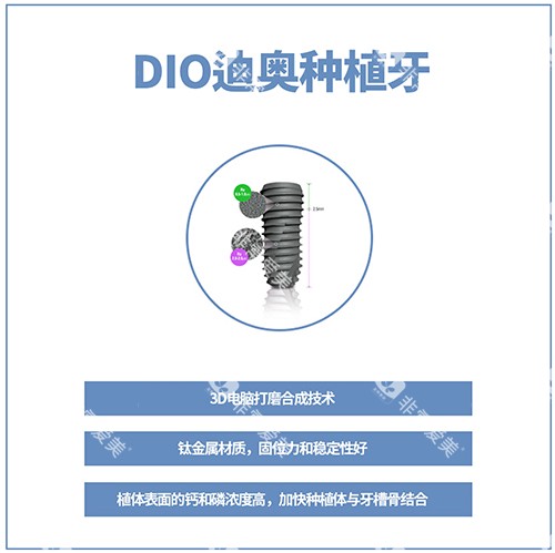 韩国DIO种植牙讲解图