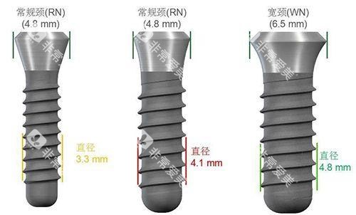 种植牙尺寸规格种类图