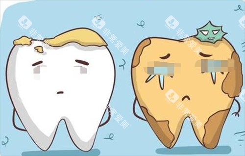 烂牙齿动画形象展示图