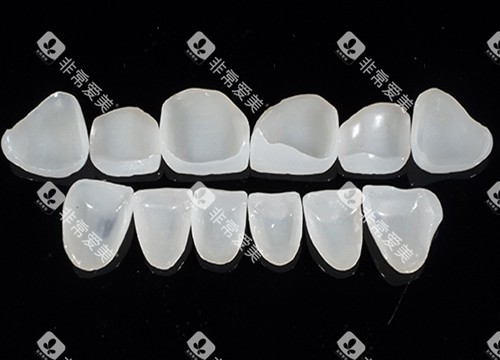 牙齿贴面玻璃陶瓷材料