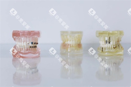 牙齿材料模型