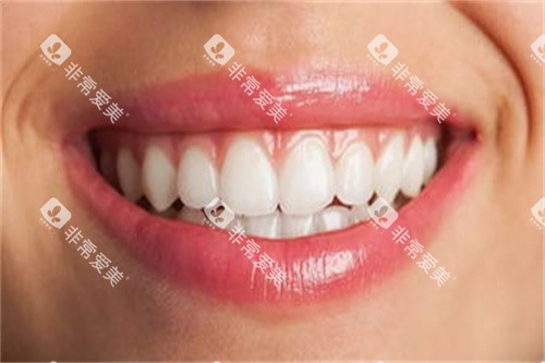 牙齿健康宣传展示