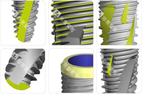 瑞士百丹特种植牙设计特写