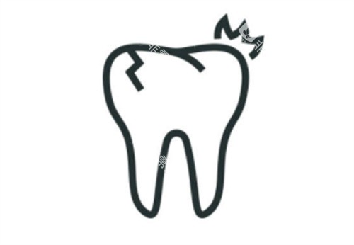 种植牙牙裂示意图