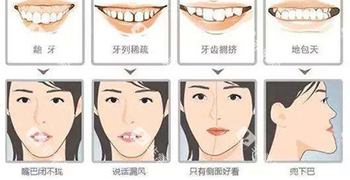 牙齿矫正脸型变化适应症