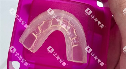 罗慕儿牙矫治器