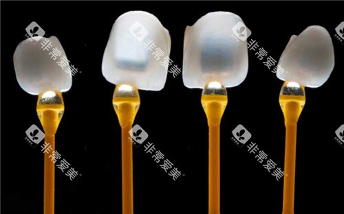 牙齿贴面透光度