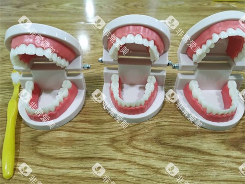 三个牙齿模型示意图 三个牙齿模型示意图