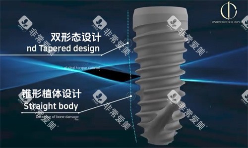 韩一种植牙优点图