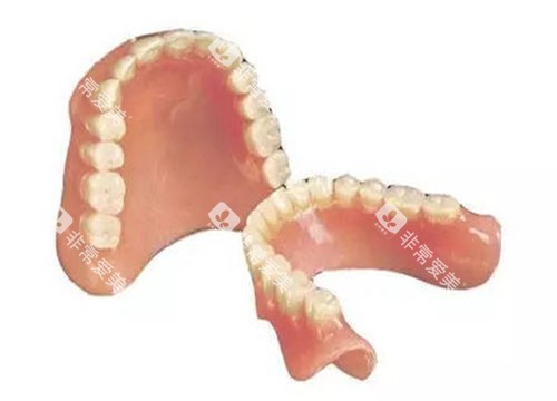 全口活动义齿
