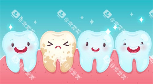 氟斑牙卡通