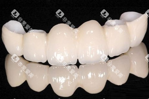 假牙半口展示图