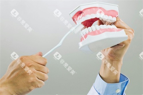 牙齿模型刷洗图展示