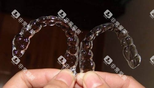 一组隐形牙套照片