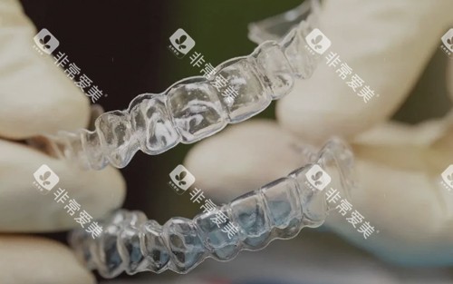 隐形透明牙套 隐形透明牙套
