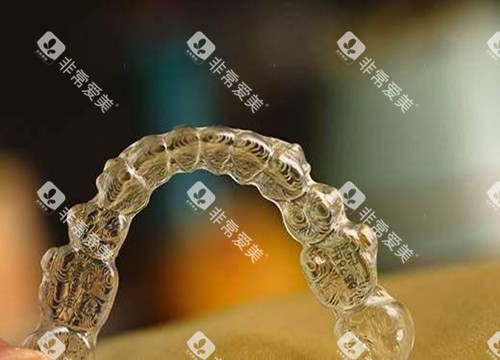 隐形矫治器示意图 隐形矫治器示意图