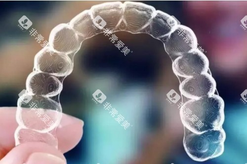 隐形矫正器模型图 隐形矫正器模型图