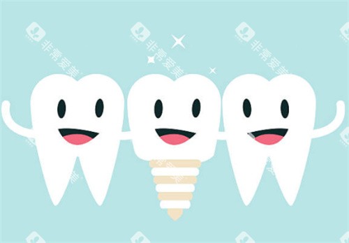 种植牙和健康牙齿图 种植牙和健康牙齿图