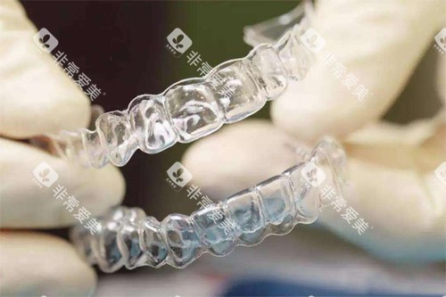牙套展示图