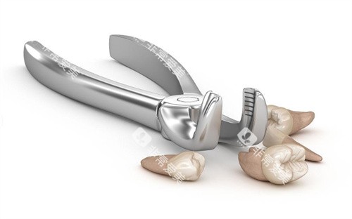 拔牙展示图卡通