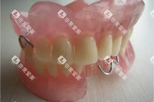 活动假牙图片一览 活动假牙图片一览