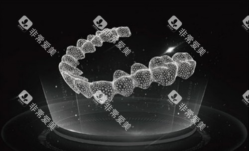 隐形牙套图示 (2)