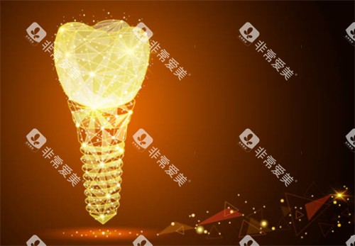 种植牙科技感背景图 种植牙科技感背景图