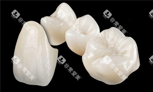 lava全瓷牙牙冠展示 lava全瓷牙牙冠展示