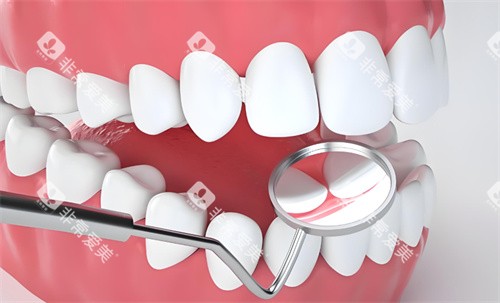 牙齿检查动画展示图