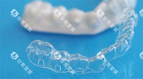 隐形牙套矫正