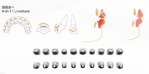 牙齿矫正OBrace球面全部托槽