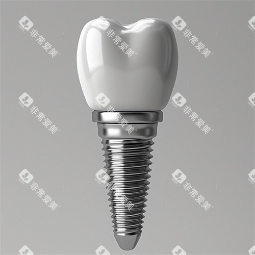 种植牙植体和牙冠一提漫画示意图 种植牙植体和牙冠一提漫画示意图