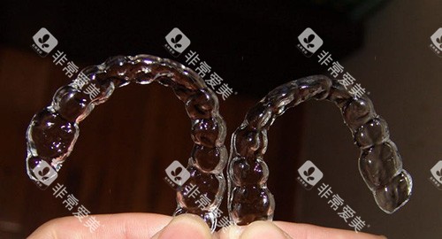 牙齿矫正隐形矫正牙套实物图