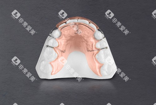 法兰克矫正器示意图