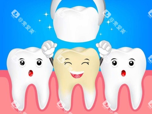 烤瓷牙义齿修复示意图