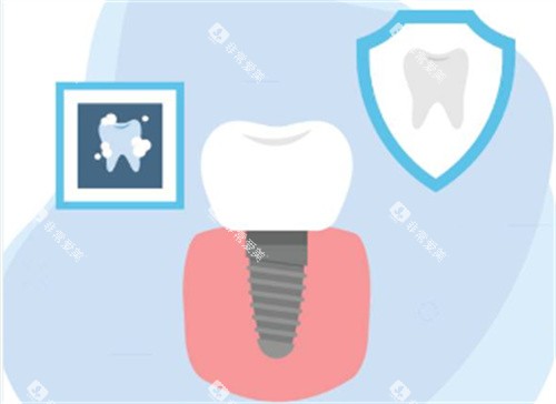 种植牙术后图 种植牙术后图