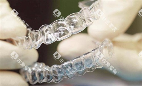 隐形牙套 隐形牙套