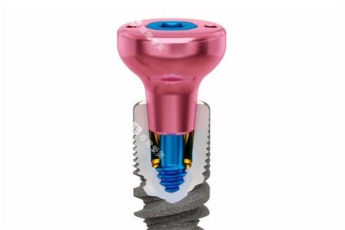 种植牙基台透视图 种植牙基台透视图