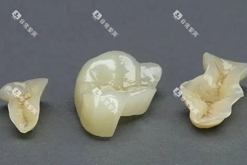 补牙部分实物 补牙部分实物