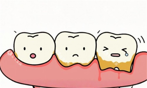 牙周炎动画图 牙周炎动画图