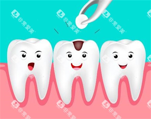 补牙改善卡通图照片 补牙改善卡通图照片