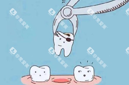 拔牙卡通图展示照片 拔牙卡通图展示照片