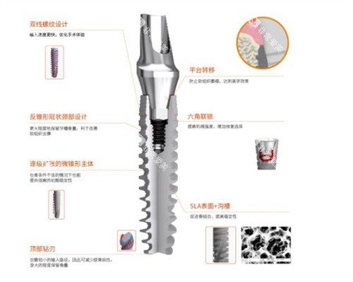 国产百齿泰种植牙优势 国产百齿泰种植牙优势