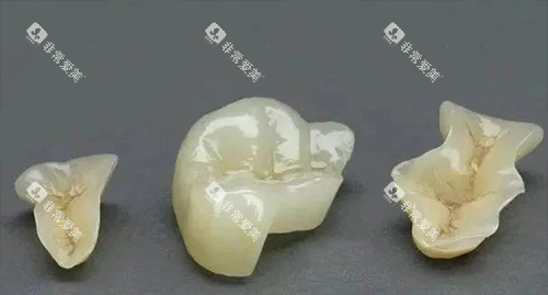 牙齿修复材料图