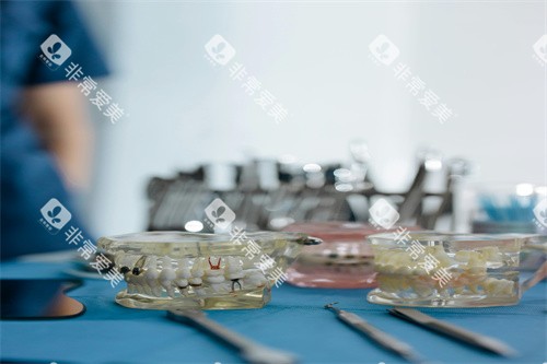 牙齿治疗的模型图